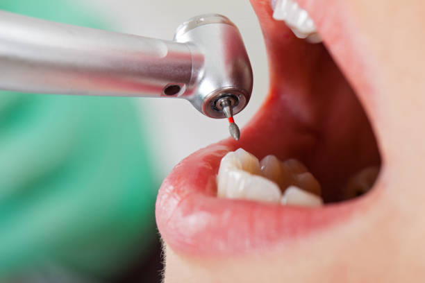 Best Emergency Treatment for Oral Infections in Pacific, WA